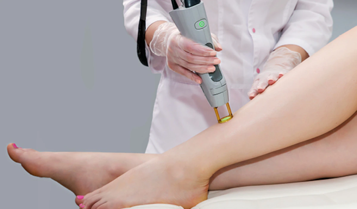 side effects of laser hair removal according to an